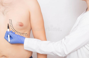 أفضل أخصائي جراحة تصغیر الثدی الرجل في إيران